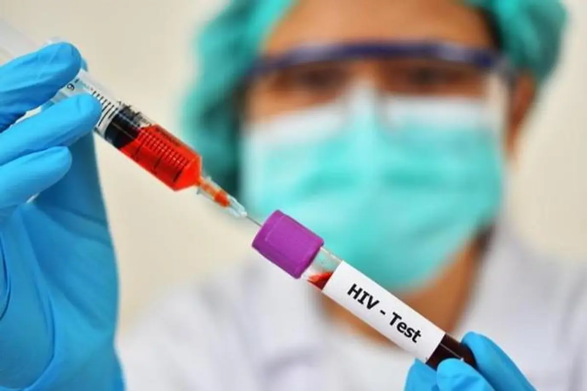 Dinkes Sumsel Catat Lonjakan 537 Kasus HIV Baru, Palembang Tertinggi